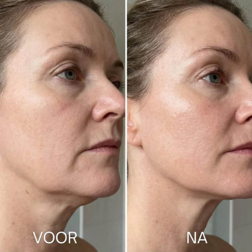 Multi Collagen Peptides Complex
